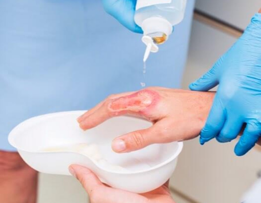 Wound Cleaning - Importance and Techniques | Flen Health